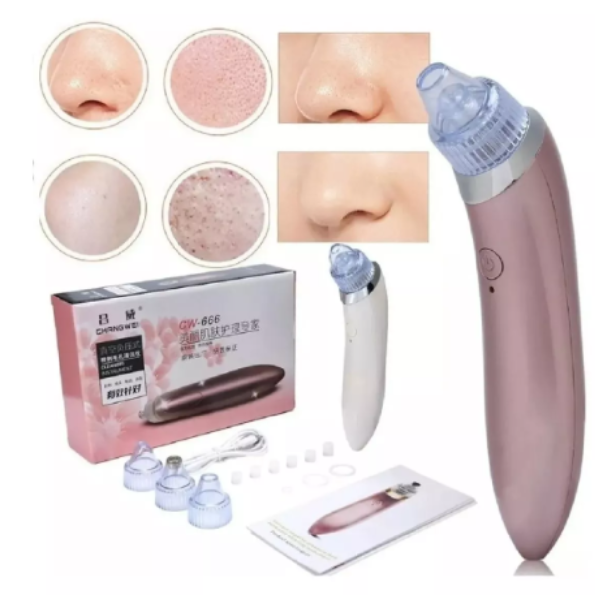 Extractor de puntos negros