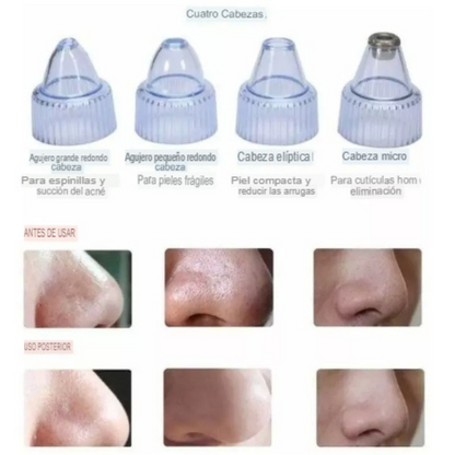 Extractor de puntos negros